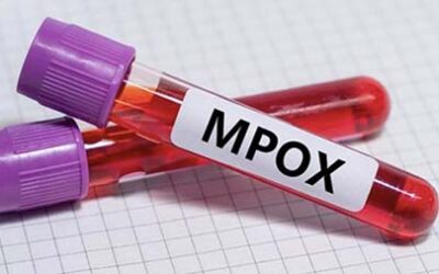 Mpox alert