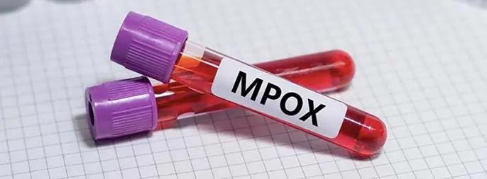 Mpox alert